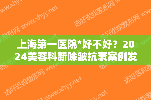 上海第一医院*好不好？2024美容科新除皱抗衰案例发布